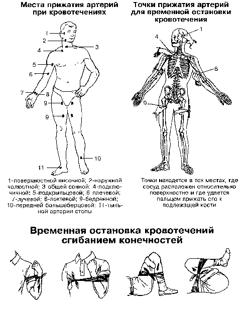 Первая помощь при кровотечениях