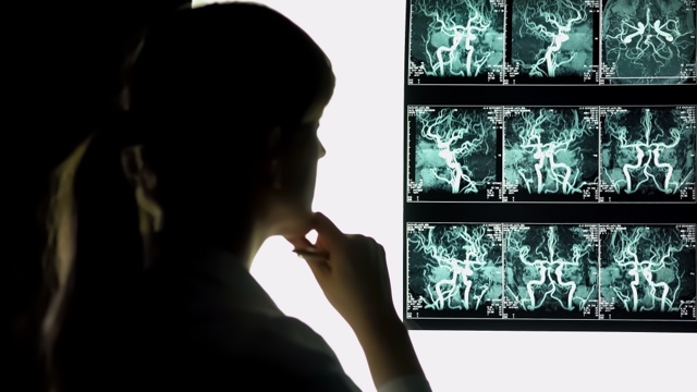 Если на лице близко расположены сосуды - Все про гипертонию