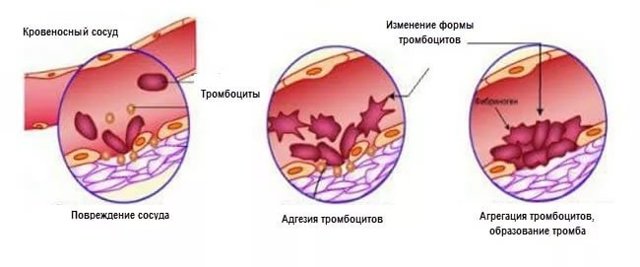 Тромбоциты в крови понижены: симптомы и лечение