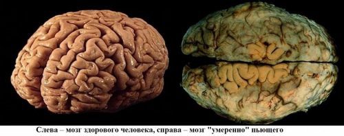 Можно ли пить алкоголь при атеросклерозе? - Диабет - 100 бед