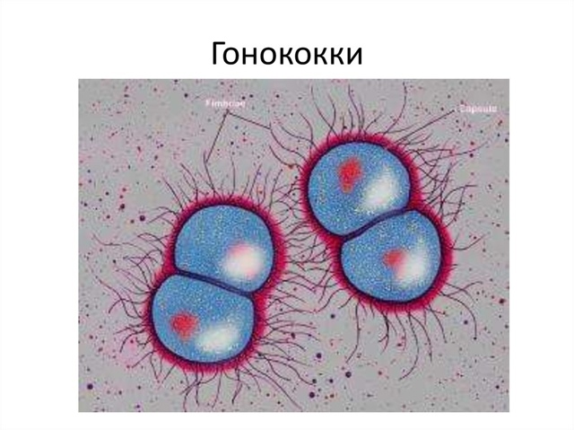 Аднексит - симптомы и лечение острой формы у женщин