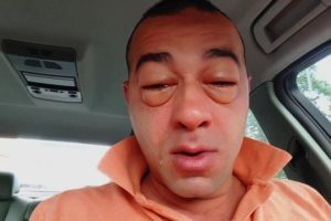 От чего помогает Рибоксин