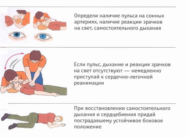 Острая сосудистая недостаточность у детей неотложная помощь. Острая сердечно-сосудистая недостаточность у детей