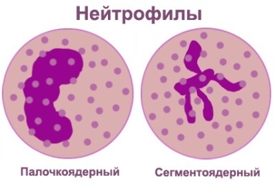 Нейтрофилы понижены в крови у ребенка или взрослого - причины, лечение и степени нейтропении
