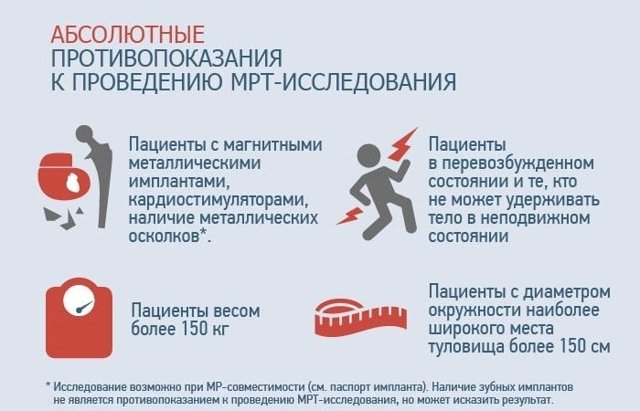 Ангиография (МРА) головного мозга. Личный опыт