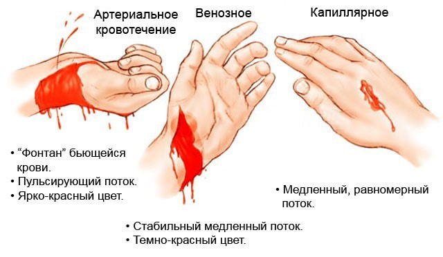 Первая помощь при капиллярном кровотечении - ОРЗ нет!