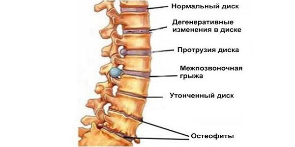 В области сердца тяжесть: причины и симптомы