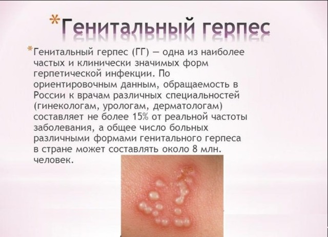 Генитальный герпес - фото проявлений у мужчин и женщин