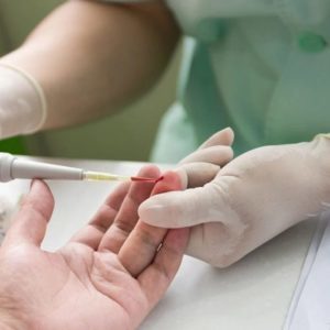 Чем прокалывают палец когда берут кровь. Зачем нужно сдавать кровь из пальца