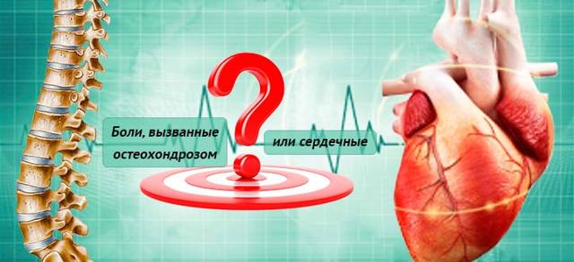 Остеохондроз грудной клетки