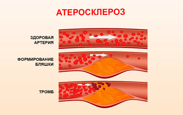 Что повышает давление водка или коньяк - Лечение гипертонии