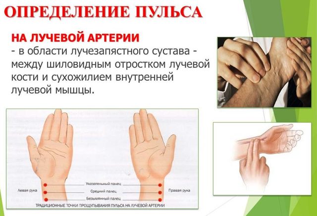 Высокий пульс при беременности: учащенный и повышенный пульс у беременных - что делать в третьем или втором триместрах