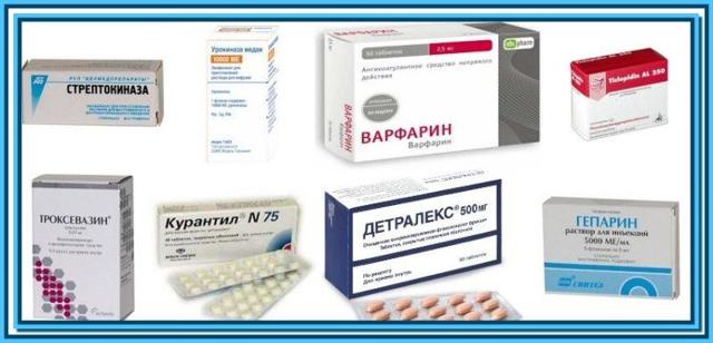 Рассасывается ли тромбоз глубоких вен