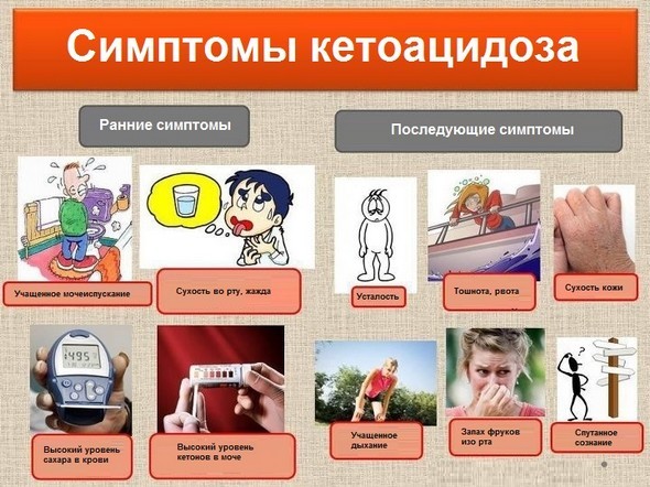 Кетоацидоз у детей и взрослых