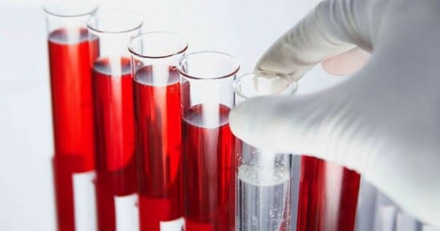 Идиопатическая тромбоцитопеническая пурпура.