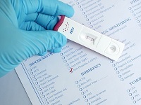 Anti hcv подтверждающий положительный что это значит — Лечим печень