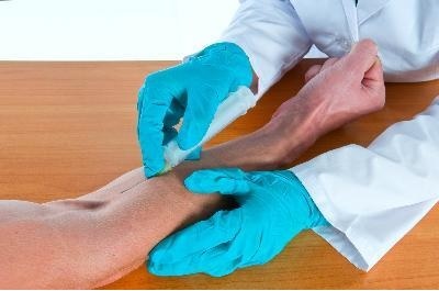 Мочевая кислота составляет уменя 755 что делать. Какая норма мочевой кислоты в крови мужчин, женщин и детей