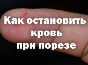 Как быстро остановить кровь при порезе, в том числе глубоком, первая помощь, медицинский клей для ран и другие средства
