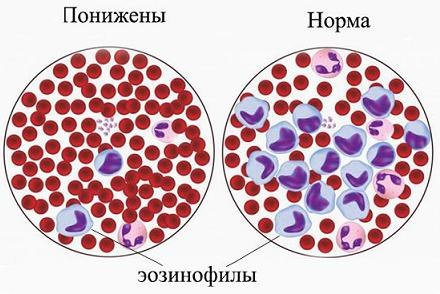 Эозинофилы в анализе как обозначаются