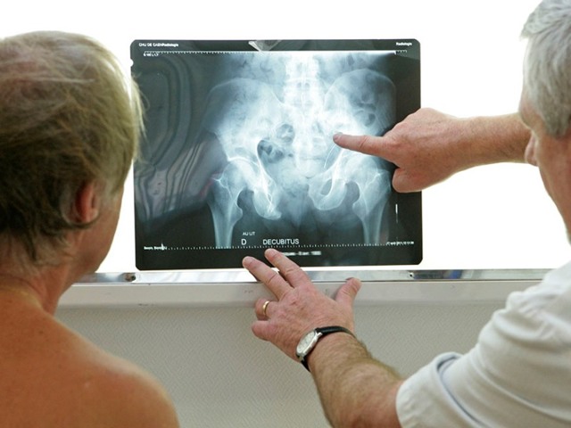 Флеболиты в малом тазу у мужчин - Все про холестерин