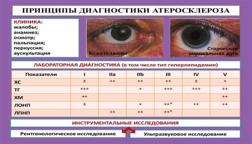 Какой врач лечит сосуды головного мозга, атеросклероз?
