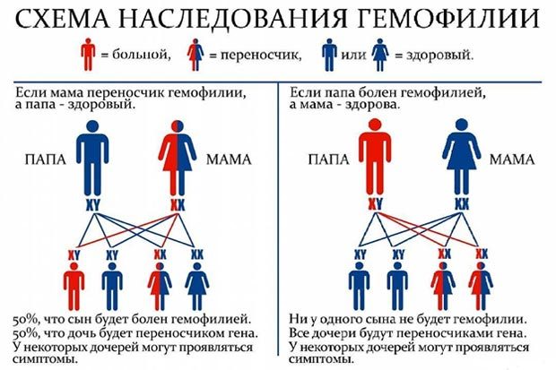 Почему гемофилия - царская болезнь