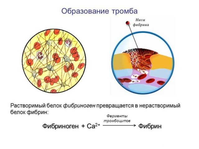 Фибриноген выше нормы – что это значит, что это такое, что делать? Фибриноген в крови – норма у женщин