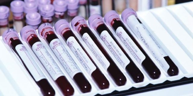 Нейтрофилы в крови понижены у взрослого, о чем это говорит