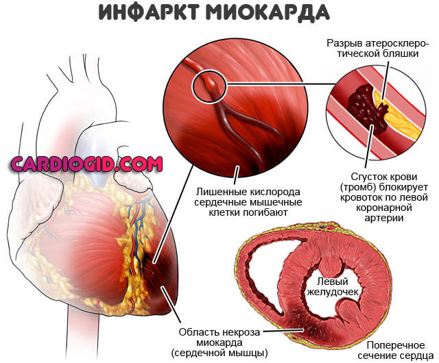 Скачет давление (то низкое, то высокое): что делать, причины, признаки
