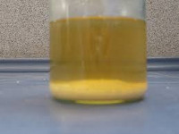 Пароксизмальная холодовая гемоглобинурия. Гемолитические анемии на почве изоиммунных тел.