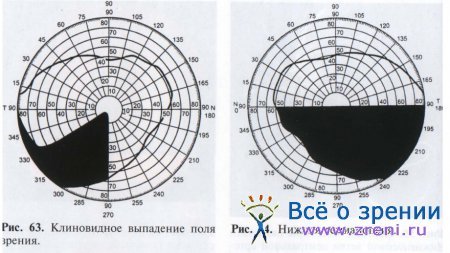 Ишемические заболевания сетчатки глаза и зрительного нерва