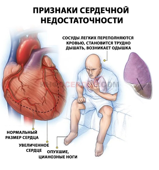 Первая помощь при острой сосудистой недостаточности