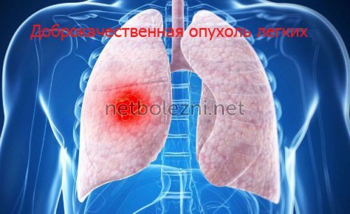 Болит и давит в грудной клетке и трудно дышать: причины боли, диагностика и лечение