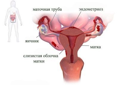 Через 14 дней месячные – Месячные через 14 дней после предыдущих: основные причины – Всё о детях – беременность, воспитание, уроки для детей