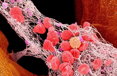 Общий белок в крови: норма у женщин и мужчин, причины повышенного и пониженного значения