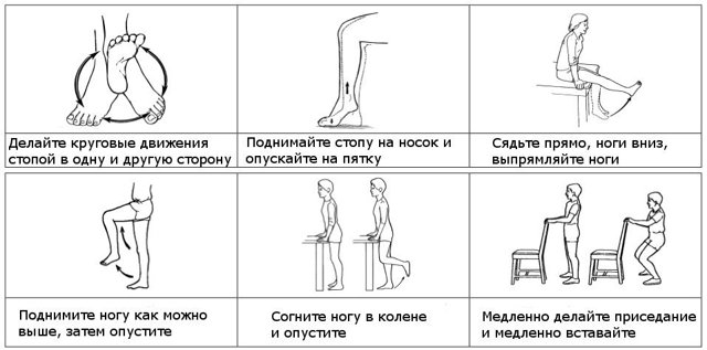 Гимнастика при варикозе вен на ногах: упражнения полезные и запрещенные