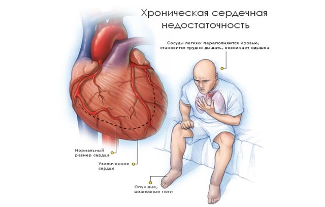Слюна с кровью: причины ее появления при кашле, по утрам и т.д.