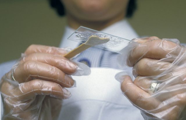 Посев крови - что это, что показывает бактериологический посев