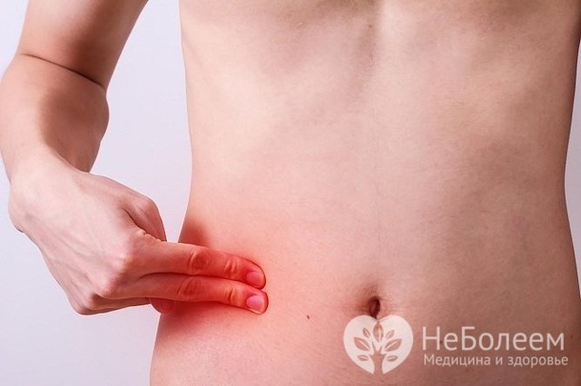 Хронический аппендицит у женщин и мужчин – симптомы, диагностика, лечение