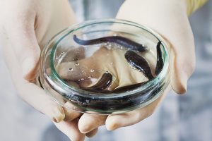 Лечение геморроя пиявками в домашних условиях