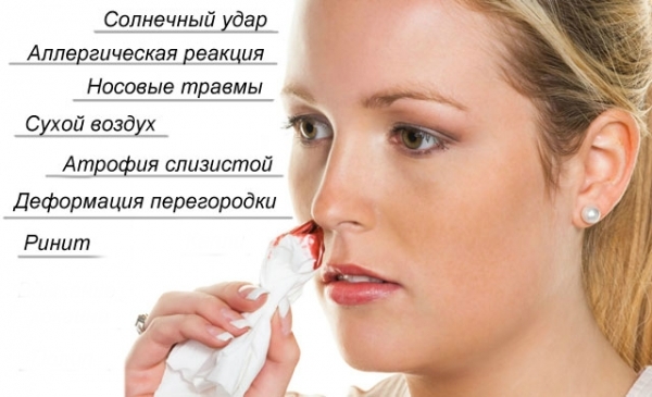 Кровь из носа при беременности: почему идет на раннем сроке, во время второго и третьего триместра, причины носовых кровотечений