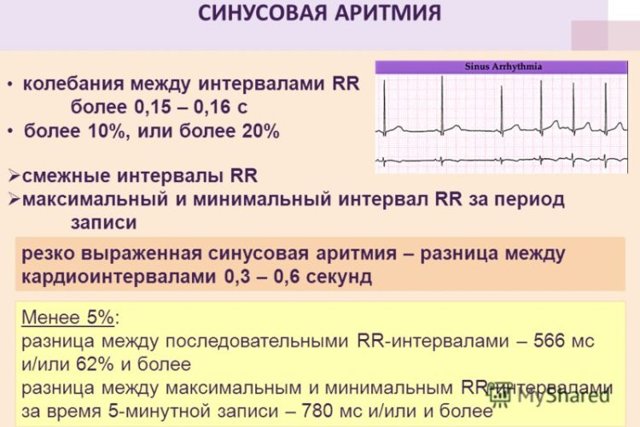 Онлайн-курс ЭКГ: ЧСС, способы ее подсчета