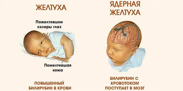 Какова норма билирубина в крови у взрослого человека? Основные показатели.