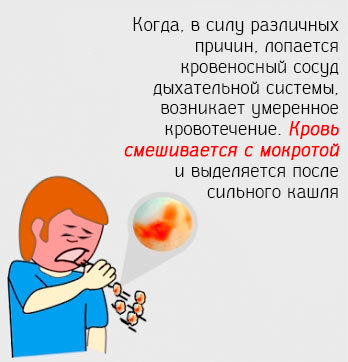 Мокрота с кровью при кашле - причины отхаркивания с прожилками, если отхаркивается без температуры, что это может быть