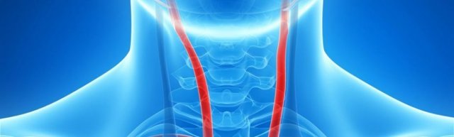 Внутренняя сонная артерия