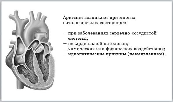 Берут ли в армию с тахикардией в 2019 году?