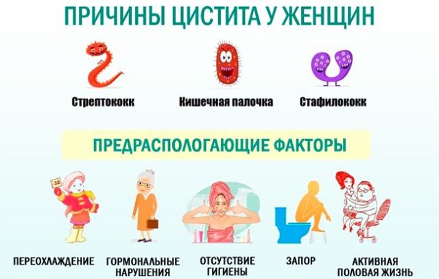 Острый цистит у женщин: симптомы и лечение