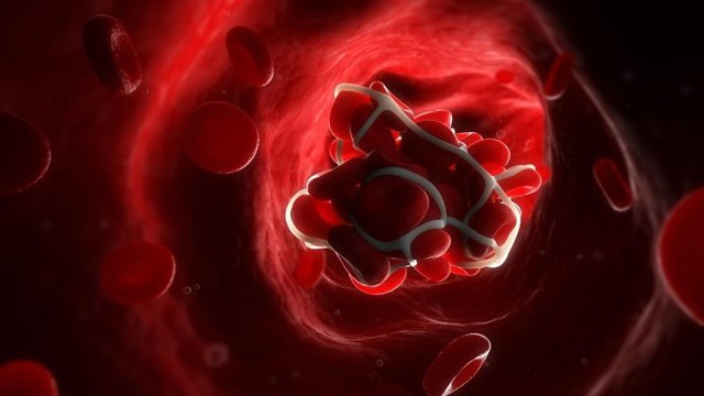 Почему может быть густая кровь у человека и как это лечится?