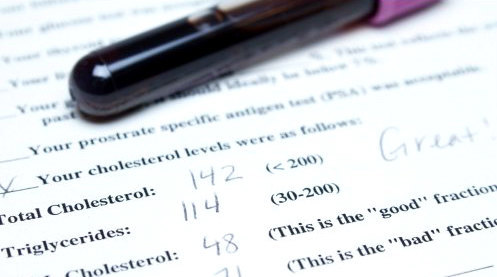 Расшифровка биохимического анализа крови – подготовка, проведение и анализ результатов