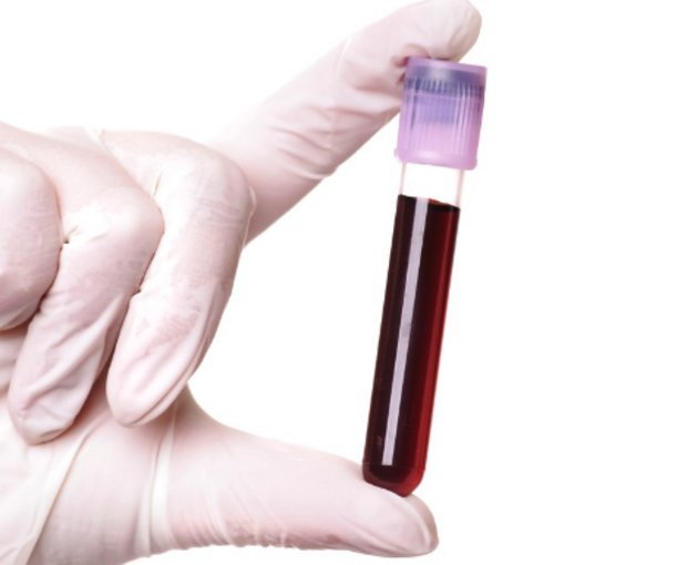 Что делать, если у ребенка повышенные эозинофилы